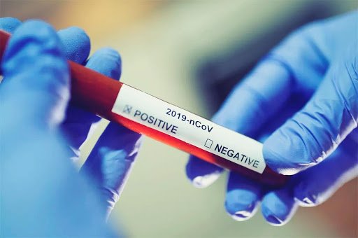 Goiás tem 927 mortes e 39.072 casos confirmados de coronavírus