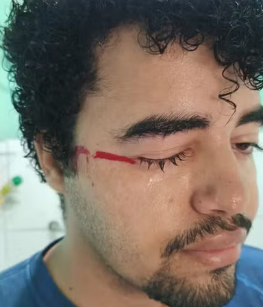 Jovem denuncia ter sido agredido por vizinha da sogra por racismo, em Goiânia