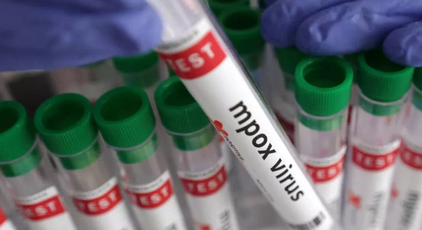 Alerta: Casos de mpox preocupam moradores da Região Norte do Brasil