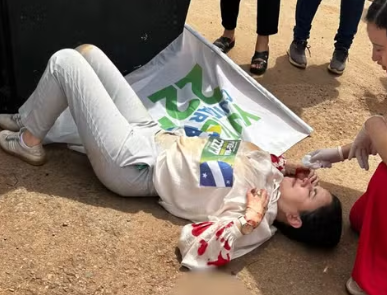 Candidata a deputada federal fratura o rosto ao cair de trio elétrico em Goiás