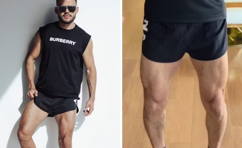 Aluno advertido em academia por usar short considerado inadequado recebe indenização de R$ 20 mil em GO